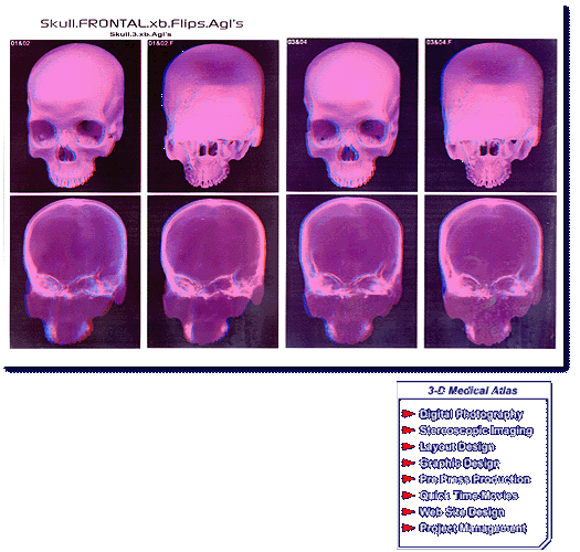 3D Skull X-Rays